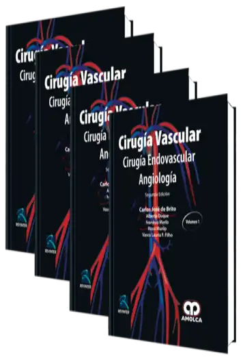 Cirugía Vascular. Cirugía Endovascular Angiología 2 Edición
