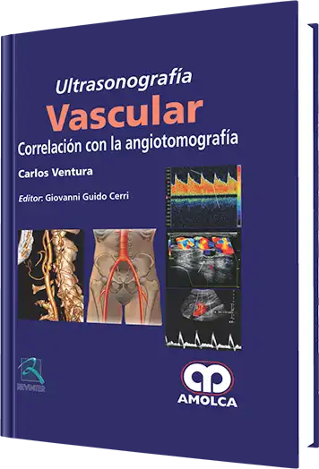 Ultrasonografía Vascular
