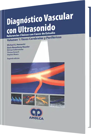 Diagnóstico Vascular con Ultrasonido Volumen 1: Vasos Cerebrales y Periféricos. 2 Edición