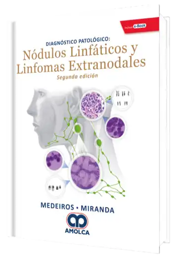 Diagnóstico Patológico Nódulos Linfáticos y Linfomas Extranodales. 2 Edición