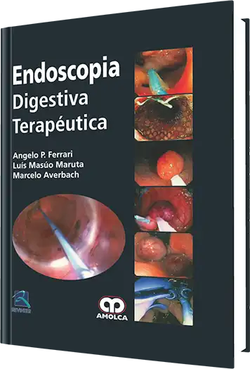 Endoscopia Digestiva Terapéutica