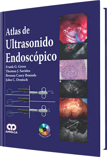 Atlas de Ultrasonido Endoscópico