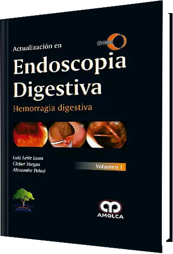 Actualización en Endoscopia Digestiva. Hemorragia Digestiva Volumen 1
