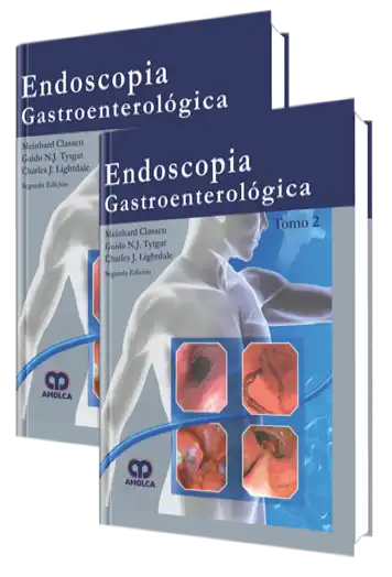 Endoscopia Gastroenterológica 2 edición