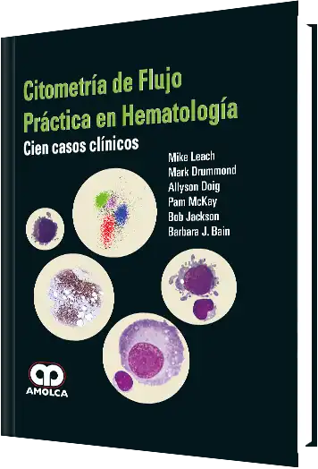 Citometría de Flujo Práctica en Hematología. Cien casos clínicos