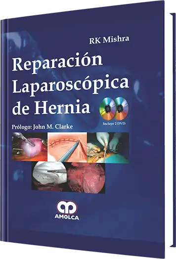 Reparación Laparoscópica de Hernia