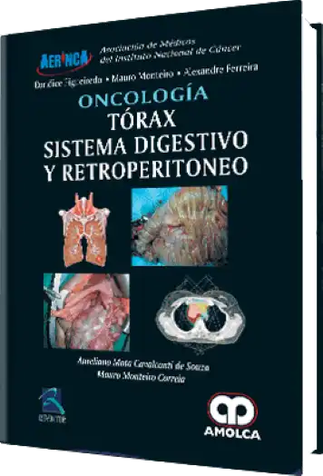 Oncología. Tórax, Sistema Digestivo y Retroperitoneo