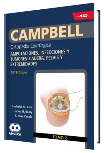 Amputaciones, Infecciones y Tumores: Cadera, Pelvis y Extremidades.  Tomo 2, 13a Edición