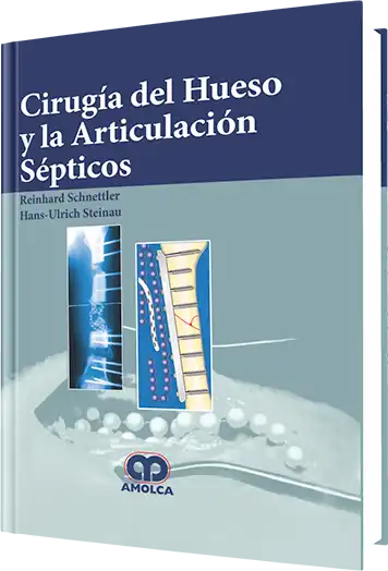 Cirugía del Hueso y la Articulación Sépticos