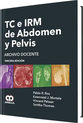 TC e IRM de Abdomen y Pelvis 3 Edición