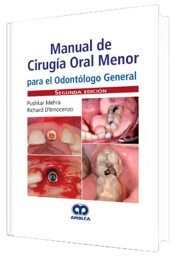 Manual de Cirugía Oral Menor para el Odontólogo General. 2 Edición