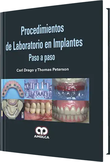 Procedimientos de Laboratorio en Implantes