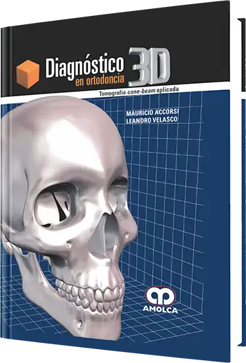 Diagnóstico 3D en Ortodoncia