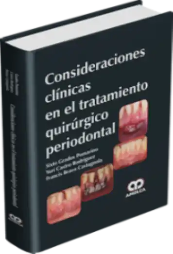 Consideraciones Clínicas en el Tratamiento Quirúrgico Periodontal