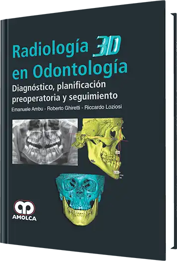 Radiología 3D en Odontología