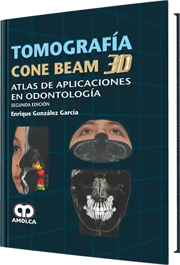 Tomografía Cone Beam 3D. 2 Edición