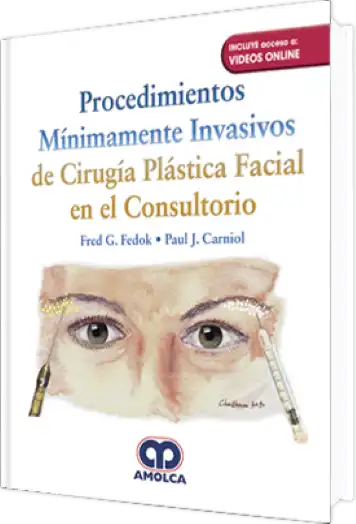 Procedimientos Mínimamente Invasivos de Cirugía Plástica Facial en el Consultorio