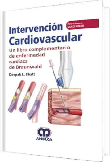 Intervención Cardiovascular