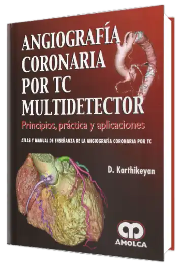 Angiografía Coronaria por TC Multidetector