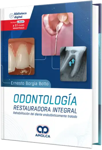 Odontología restauradora integral. Rehabilitación del diente endodónticamente tratado