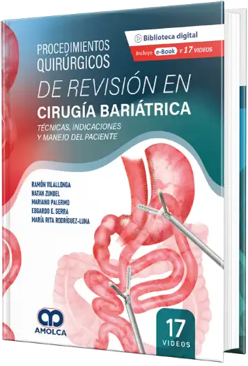 Procedimientos Quirúrgicos de Revisión en Cirugía Bariátrica. Técnicas, Indicaciones y Manejo del Paciente